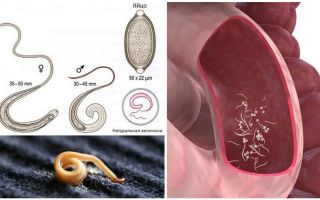 वयस्कों और बच्चों में pinworms कैसे निकालें