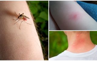 Jaka jest różnica między ukąszeniem komara a ukąszeniem robaka lub kleszcza?