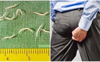 Sintomas e tratamento de vermes em adultos