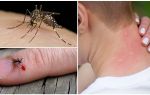 Co jeśli komary ugryzą