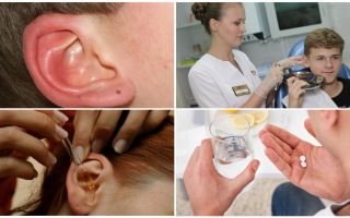 Atzīmējiet personas auss: simptomi un ārstēšana