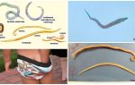 Forskelle Ascaris fra pinworms og andre orme