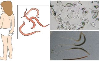 O que são vermes e como eles se parecem