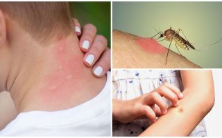 Dlaczego komar gryzie swędzenie