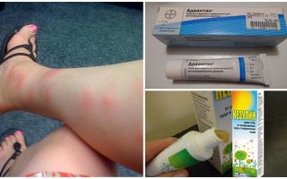 Por que em adultos e crianças após as picadas de mosquitos aparecem colisões do que para tratar