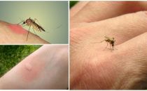 Dlaczego komary gryzą niektórych ludzi bardziej niż innych