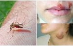 Hvilke sygdomme lider myg