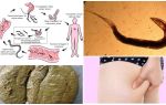 Apa pinworms kelihatan seperti dalam tinja