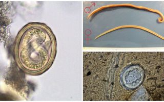 Lo schema del ciclo di vita dello sviluppo del nematode umano