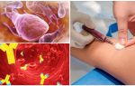 Blodtest på lamblia: hva, hvordan og hvor skal passere, kost og transkripsjon