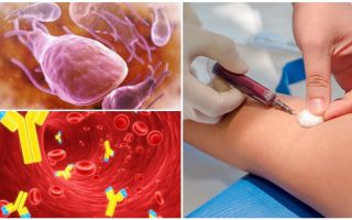 लैम्ब्लिया के लिए रक्त परीक्षण: क्या, कैसे और कहाँ पास करना, लागत और डिकोडिंग