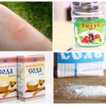 Komarac ugriza svrbi pomaže ukloniti sol octa i soda