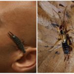 Earwig in the ear