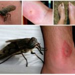 Morsure d'insecte sur le corps humain