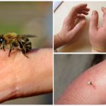 Šteta od uboda pčela