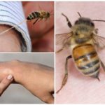 Prednosti uboda pčela