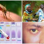 Virusi Zika, Zapadni Nil i Žuta groznica
