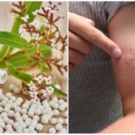 Homeopathic remedies for a negative reaction to mosquito bites