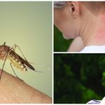 Ujedi komaraca