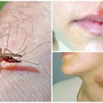 Malaria og tularemi for mygg