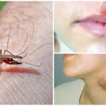 Malaria dan tularemia untuk nyamuk