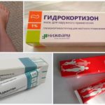 Tratamentul edemului cu medicamente hormonale