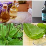 Folk remedies voor muggenbeten