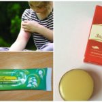 Remedies voor muggenbeten