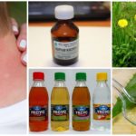 Folk remedies voor muggenbeten