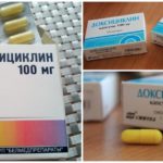 Doxycycline trong điều trị vết mổ