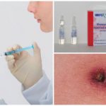 Immunoglobulines encefalitis transmeses per garrapates