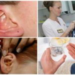 Sveobuhvatno liječenje ušnih grinja