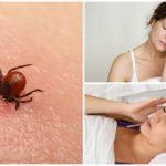 Signs of tick-borne encephalitis