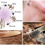 Demodex hama pada peringkat pembangunan yang berlainan