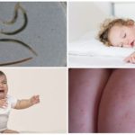 Pinworms hos børn under et år