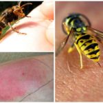 Wasp sting nguy hiểm