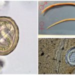 Roundworm and their eggs