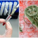 Prueba de sangre para Giardia